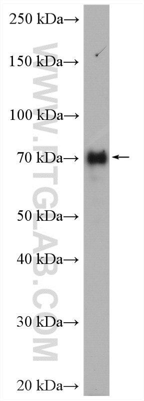 Western Blot (WB) analysis of A431 cells using SCEL Polyclonal antibody (11906-1-AP)