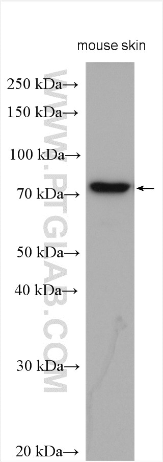 Western Blot (WB) analysis of various lysates using SCEL Polyclonal antibody (11906-1-AP)