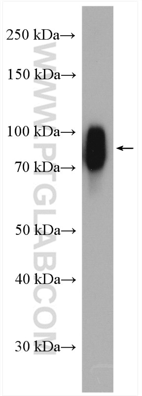 Western Blot (WB) analysis of human saliva using SCEL Polyclonal antibody (11906-1-AP)