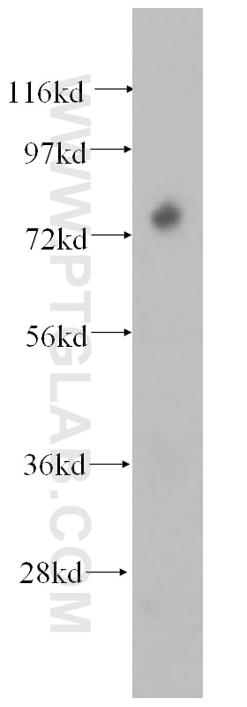 Western Blot (WB) analysis of human skin tissue using SCEL Polyclonal antibody (11906-1-AP)