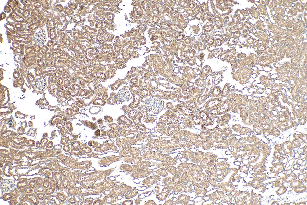 Immunohistochemical analysis of paraffin-embedded mouse kidney tissue slide using 23844-1-AP (SCF antibody) at dilution of 1:200 (under 10x lens). Heat mediated antigen retrieval with Tris-EDTA buffer (pH 9.0). Immunohistochemistry (IHC) staining of mouse kidney tissue using SCF Polyclonal antibody (23844-1-AP)