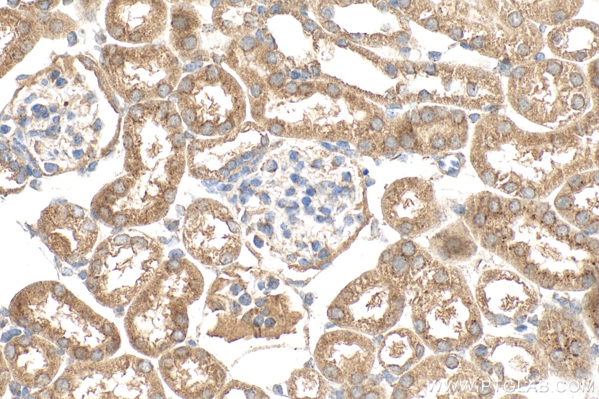 Immunohistochemical analysis of paraffin-embedded mouse kidney tissue slide using 23844-1-AP (SCF antibody) at dilution of 1:200 (under 40x lens). Heat mediated antigen retrieval with Tris-EDTA buffer (pH 9.0). Immunohistochemistry (IHC) staining of mouse kidney tissue using SCF Polyclonal antibody (23844-1-AP)
