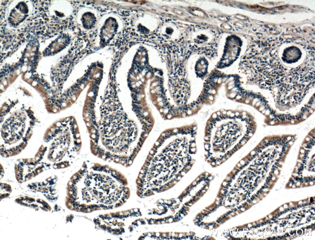 Immunohistochemistry (IHC) staining of human small intestine tissue using SCF Polyclonal antibody (26582-1-AP)