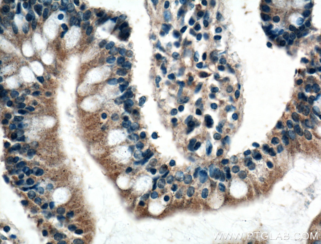 Immunohistochemistry (IHC) staining of human small intestine tissue using SCF Polyclonal antibody (26582-1-AP)