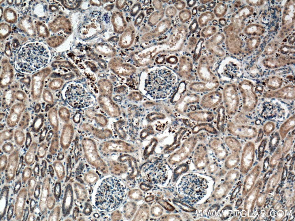 Immunohistochemistry (IHC) staining of human kidney tissue using SCF Polyclonal antibody (26582-1-AP)
