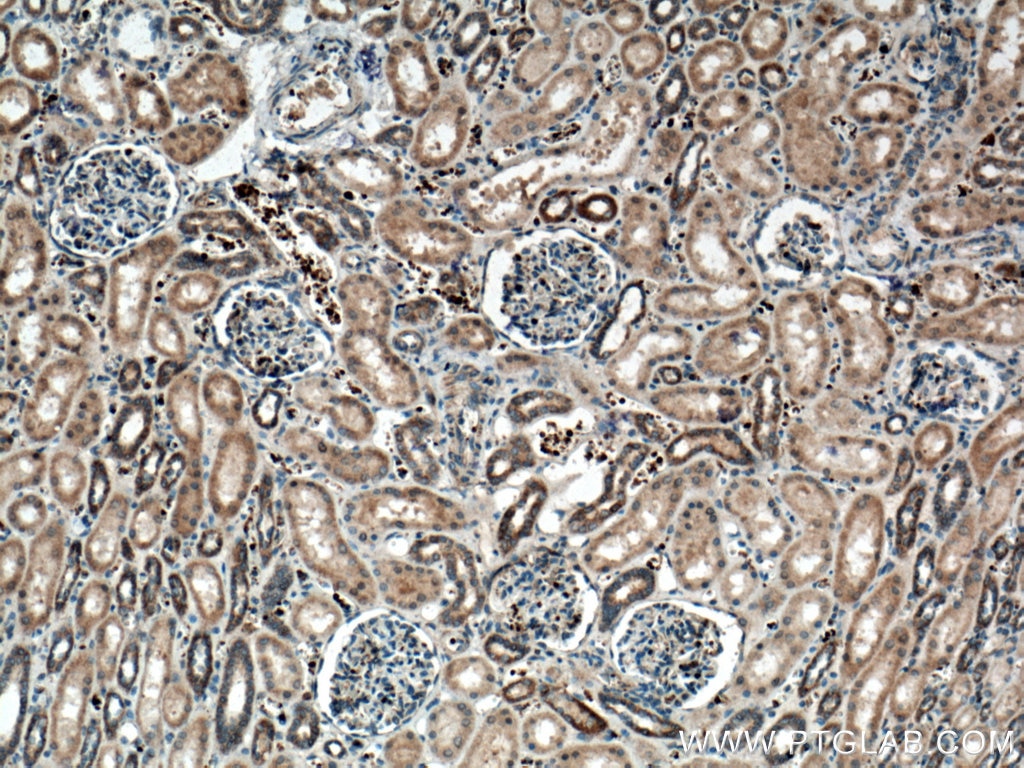 IHC staining of human kidney using 26582-1-AP