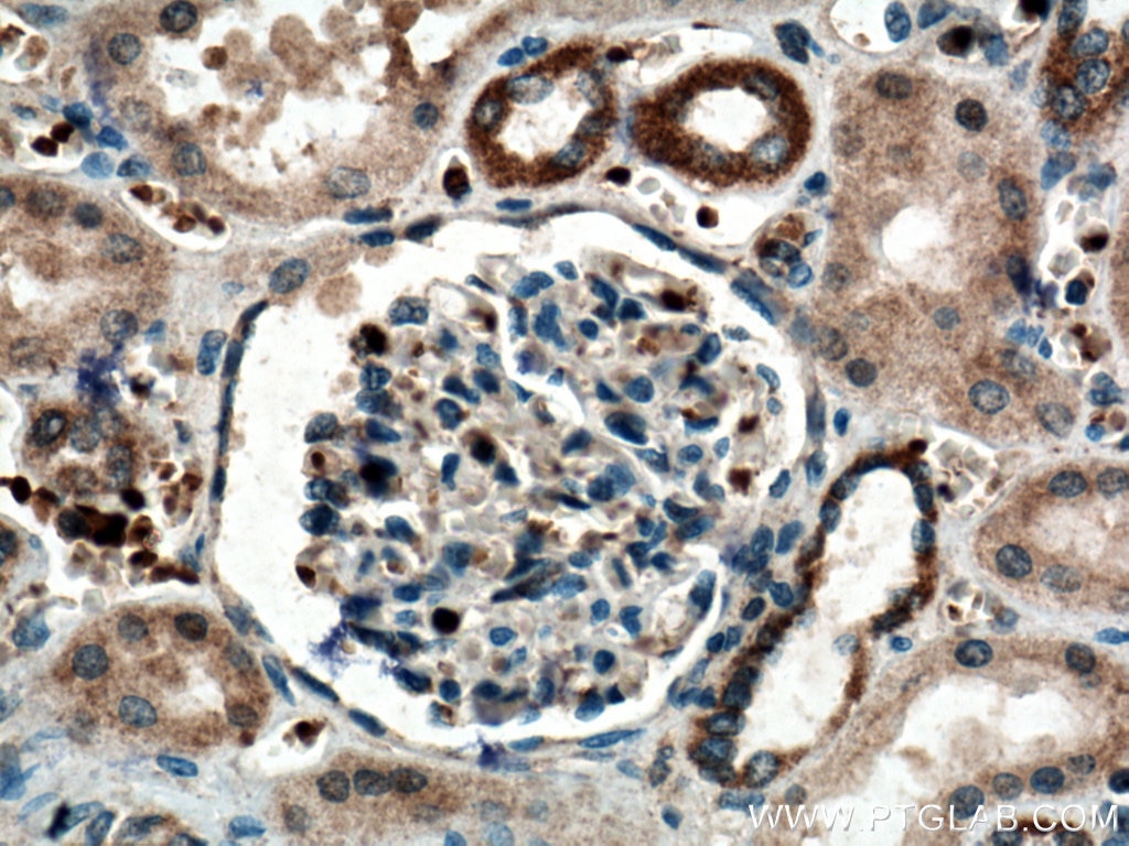 Immunohistochemistry (IHC) staining of human kidney tissue using SCF Polyclonal antibody (26582-1-AP)