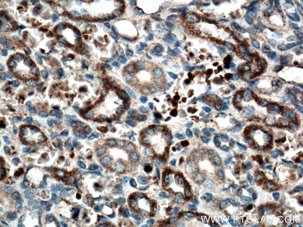 Immunohistochemistry (IHC) staining of human kidney tissue using SCF Polyclonal antibody (26582-1-AP)