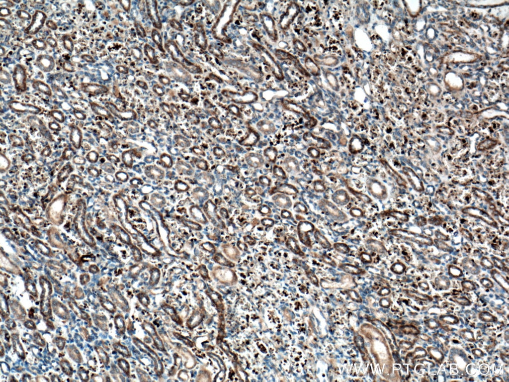 Immunohistochemistry (IHC) staining of human kidney tissue using SCF Polyclonal antibody (26582-1-AP)