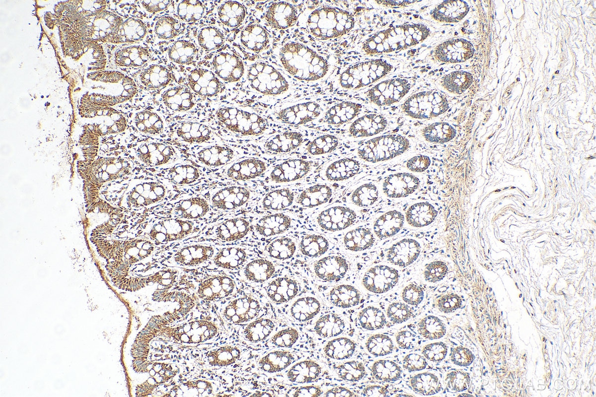 Immunohistochemistry (IHC) staining of human colon tissue using SCF Polyclonal antibody (26582-1-AP)