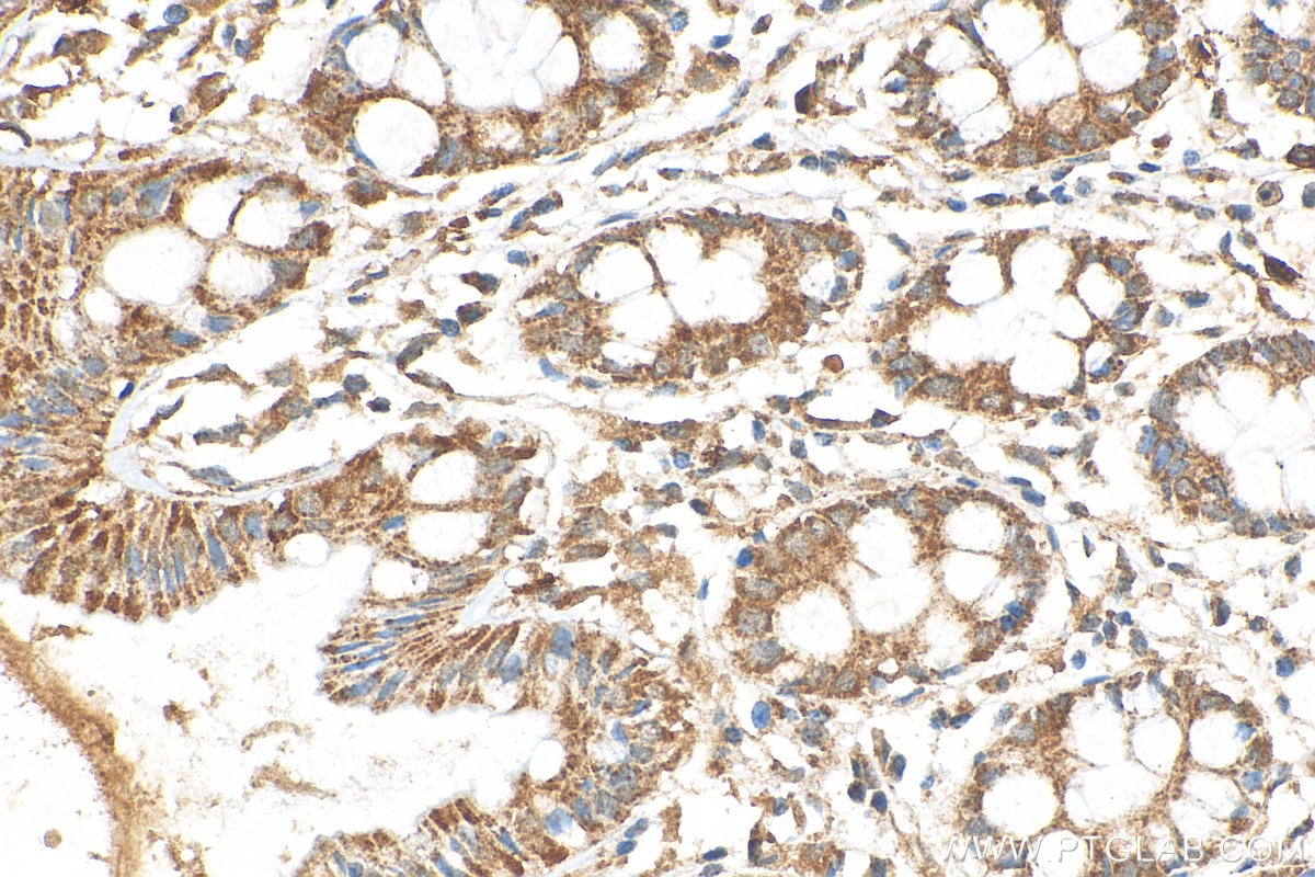 IHC staining of human colon using 26582-1-AP