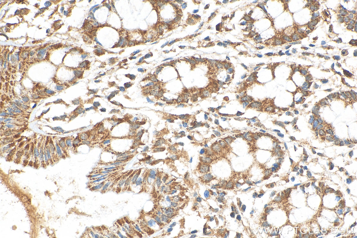 Immunohistochemistry (IHC) staining of human colon tissue using SCF Polyclonal antibody (26582-1-AP)