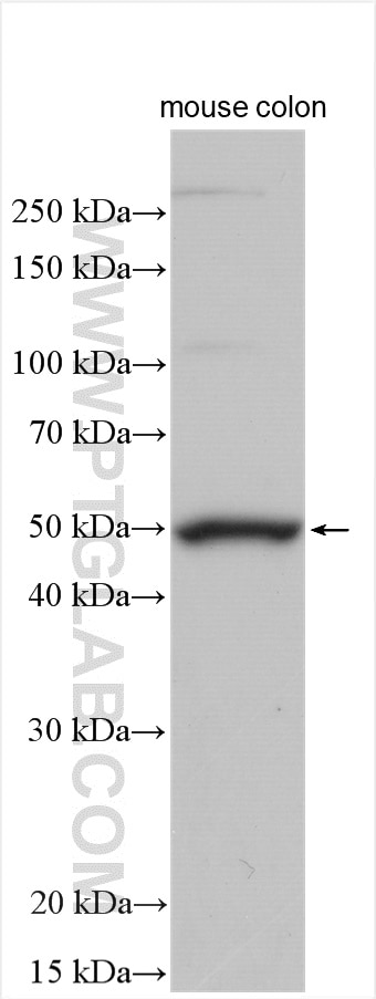 Western Blot (WB) analysis of mouse colon tissue using SCF Polyclonal antibody (26582-1-AP)