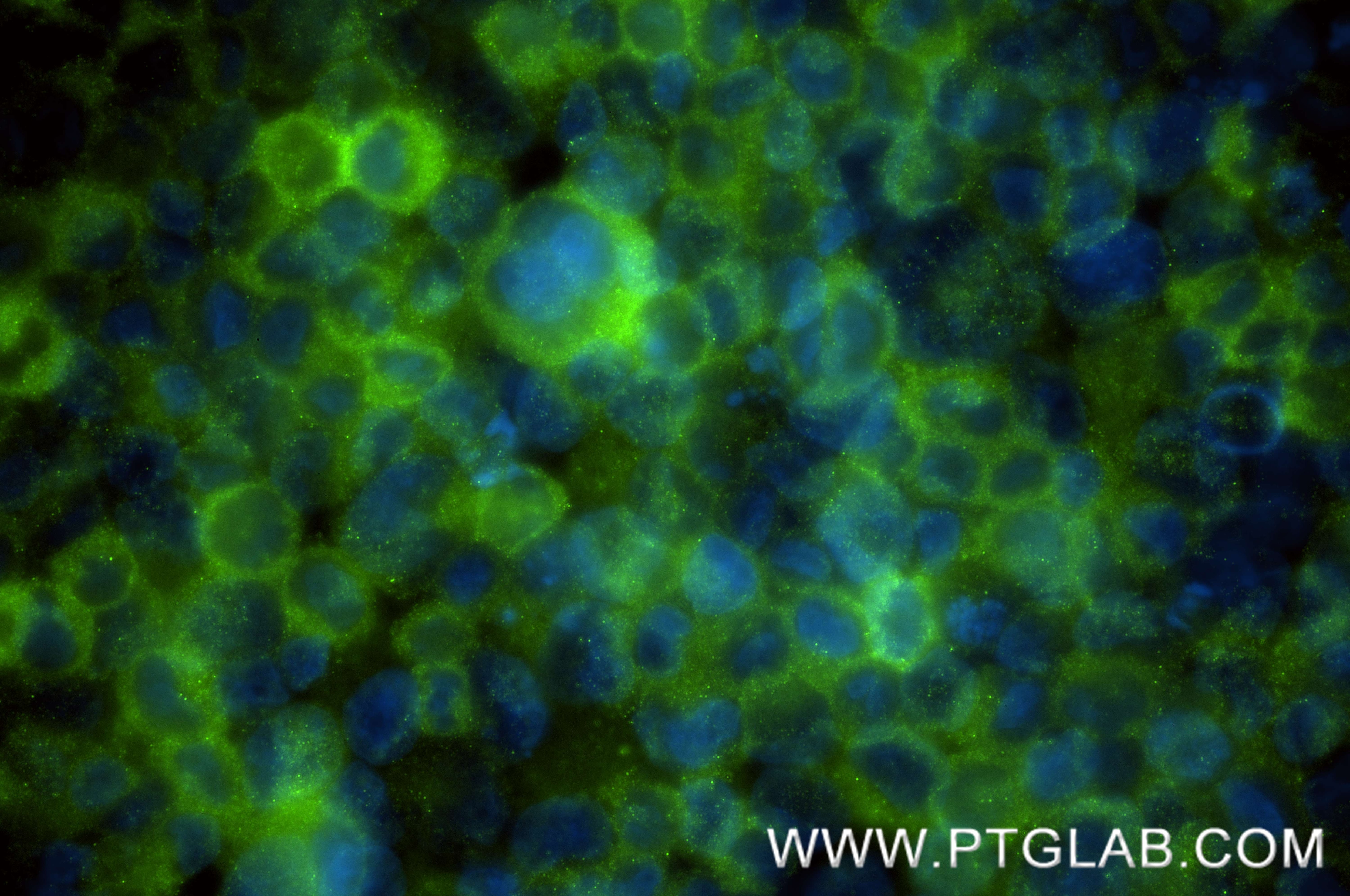 IF Staining of K-562 using 84118-7-RR Immunofluorescence (IF) / fluorescent staining of K-562 cells using SCF Recombinant monoclonal antibody (84118-7-RR)