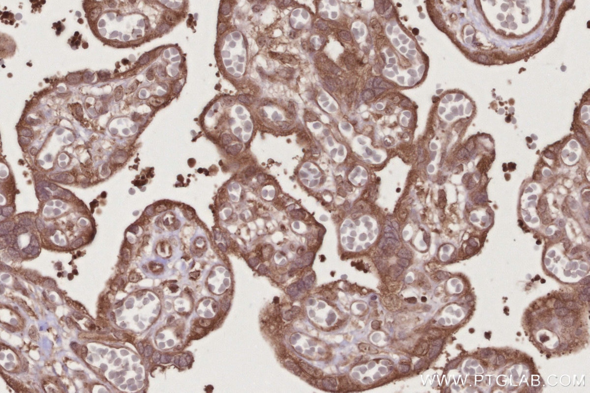 IHC staining of human placenta using 12569-1-AP Immunohistochemistry (IHC) staining of human placenta tissue using SCFD1 Polyclonal antibody (12569-1-AP)