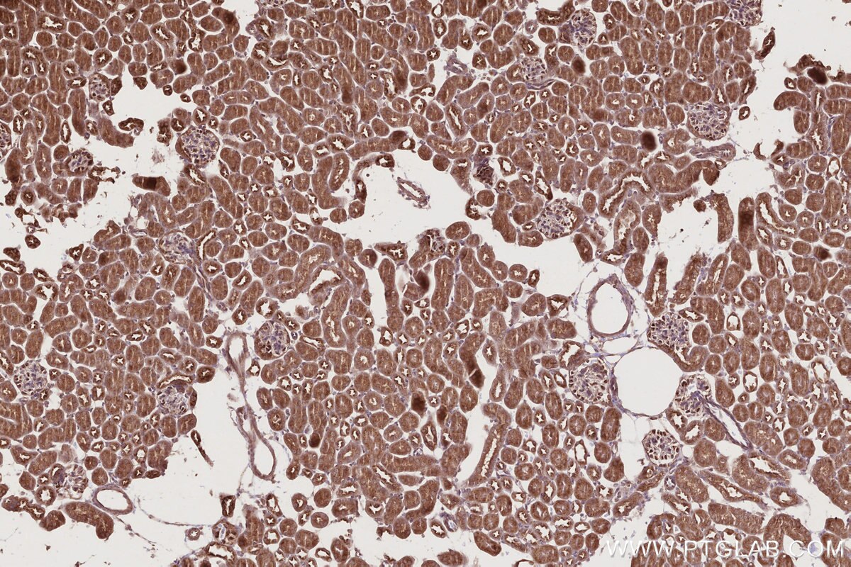IHC staining of mouse kidney using 12569-1-AP Immunohistochemistry (IHC) staining of mouse kidney tissue using SCFD1 Polyclonal antibody (12569-1-AP)