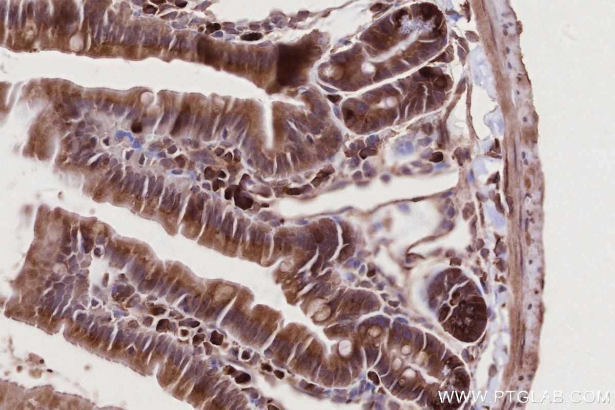 IHC staining of mouse small intestine using 12569-1-AP Immunohistochemistry (IHC) staining of mouse small intestine tissue using SCFD1 Polyclonal antibody (12569-1-AP)
