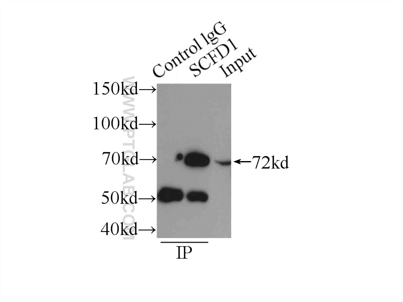Immunoprecipitation (IP) experiment of HeLa cells using SCFD1 Polyclonal antibody (12569-1-AP)