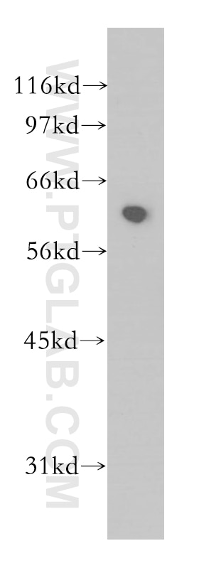 Western Blot (WB) analysis of human kidney tissue using SCFD1 Polyclonal antibody (12569-1-AP)