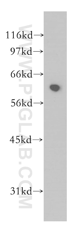 WB analysis of human kidney using 12569-1-AP