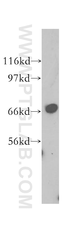 Western Blot (WB) analysis of A549 cells using SCFD1 Polyclonal antibody (12569-1-AP)