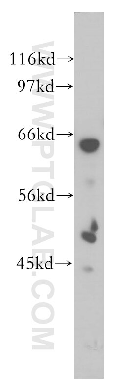 Western Blot (WB) analysis of human liver tissue using SCFD1 Polyclonal antibody (12569-1-AP)