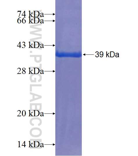 SCFD1 fusion protein Ag19396 SDS-PAGE