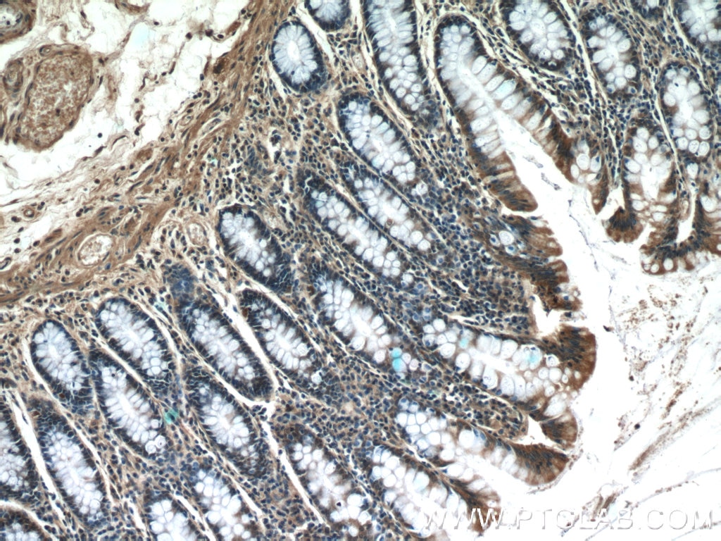 Immunohistochemistry (IHC) staining of human colon tissue using SCFD2 Polyclonal antibody (13375-1-AP)