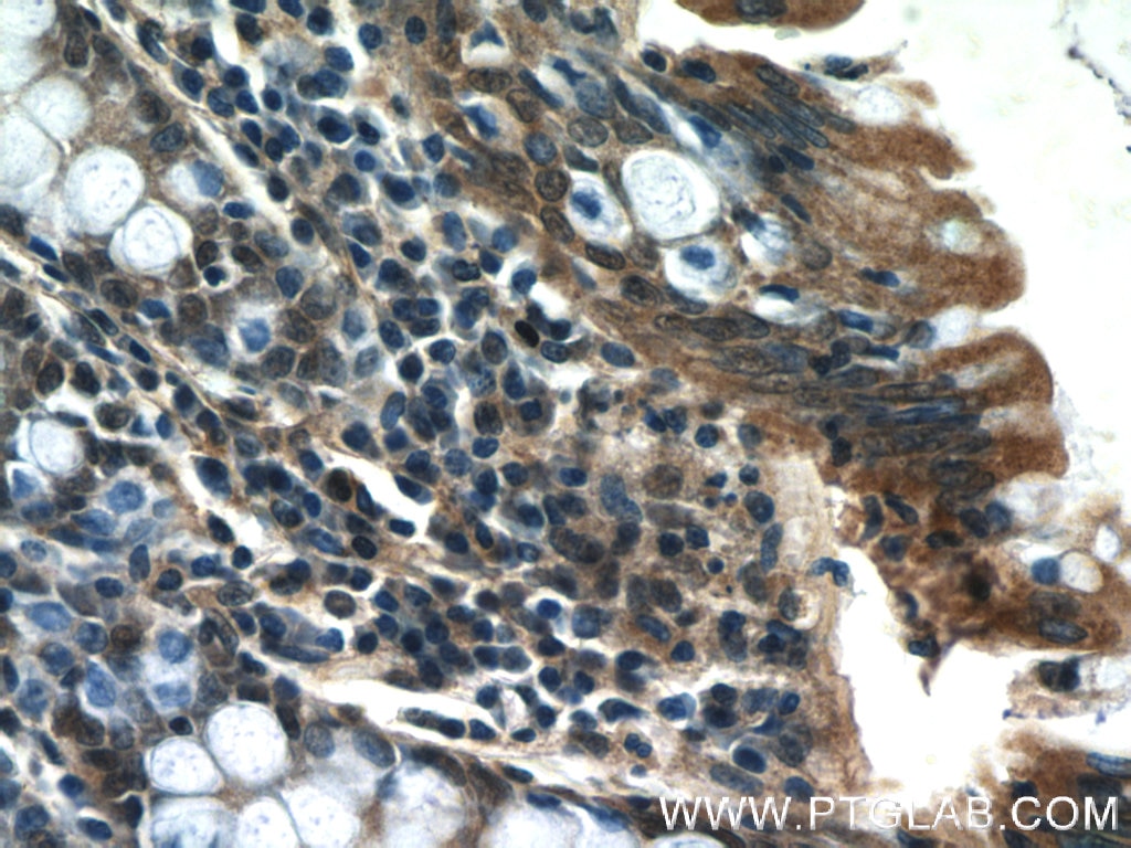 Immunohistochemistry (IHC) staining of human colon tissue using SCFD2 Polyclonal antibody (13375-1-AP)