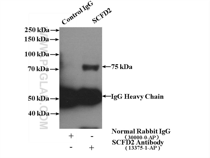 Immunoprecipitation (IP) experiment of COLO 320 cells using SCFD2 Polyclonal antibody (13375-1-AP)