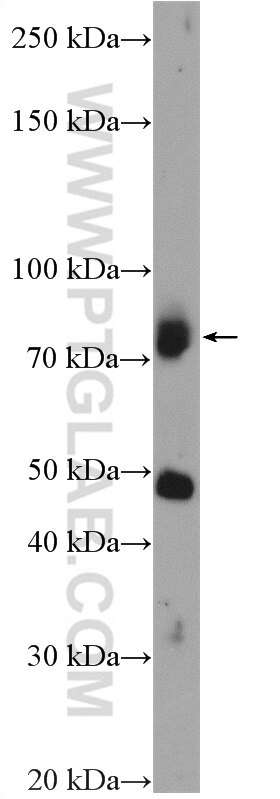 Western Blot (WB) analysis of COLO 320 cells using SCFD2 Polyclonal antibody (13375-1-AP)