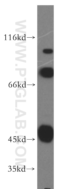 Western Blot (WB) analysis of COLO 320 cells using SCFD2 Polyclonal antibody (13375-1-AP)
