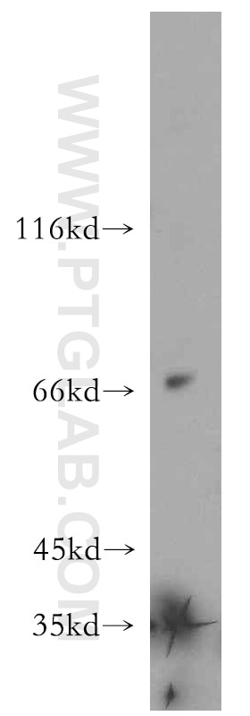 Secretogranin II Polyclonal antibody