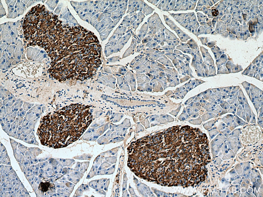 IHC staining of mouse pancreas using 10954-1-AP
