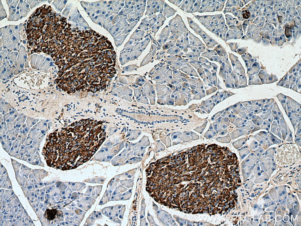 Immunohistochemistry (IHC) staining of mouse pancreas tissue using Secretogranin III Polyclonal antibody (10954-1-AP)