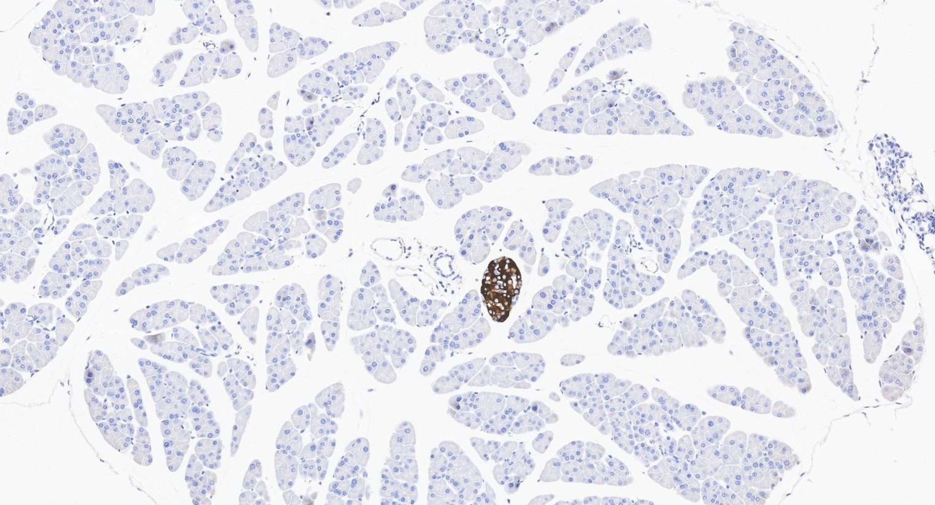 IHC staining of mouse pancreas using 10954-1-AP Immunohistochemistry (IHC) staining of mouse pancreas tissue using Secretogranin III Polyclonal antibody (10954-1-AP)