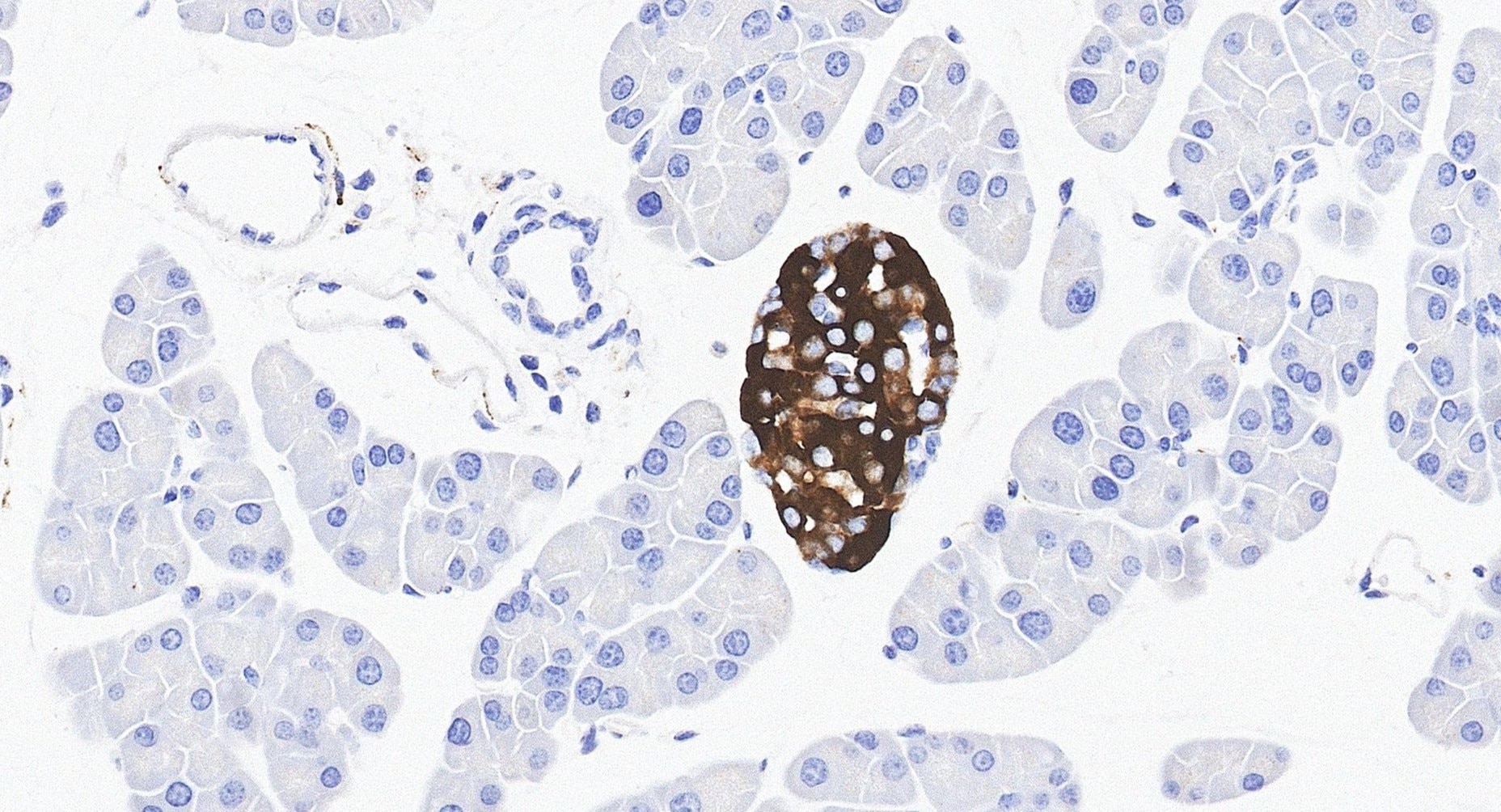IHC staining of mouse pancreas using 10954-1-AP Immunohistochemistry (IHC) staining of mouse pancreas tissue using Secretogranin III Polyclonal antibody (10954-1-AP)
