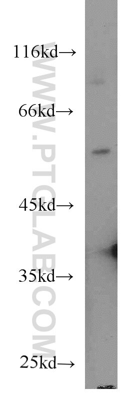 Western Blot (WB) analysis of human heart tissue using Secretogranin III Monoclonal antibody (66029-1-Ig)