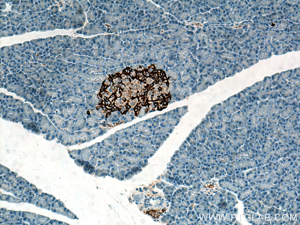 Immunohistochemistry (IHC) staining of rat pancreas tissue using Secretogranin V Polyclonal antibody (10761-1-AP)