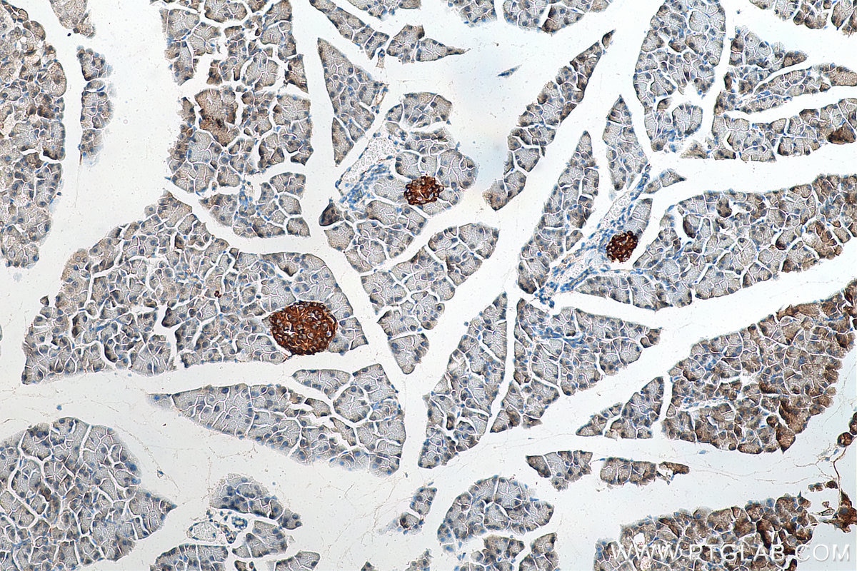 IHC staining of mouse pancreas using 10761-1-AP