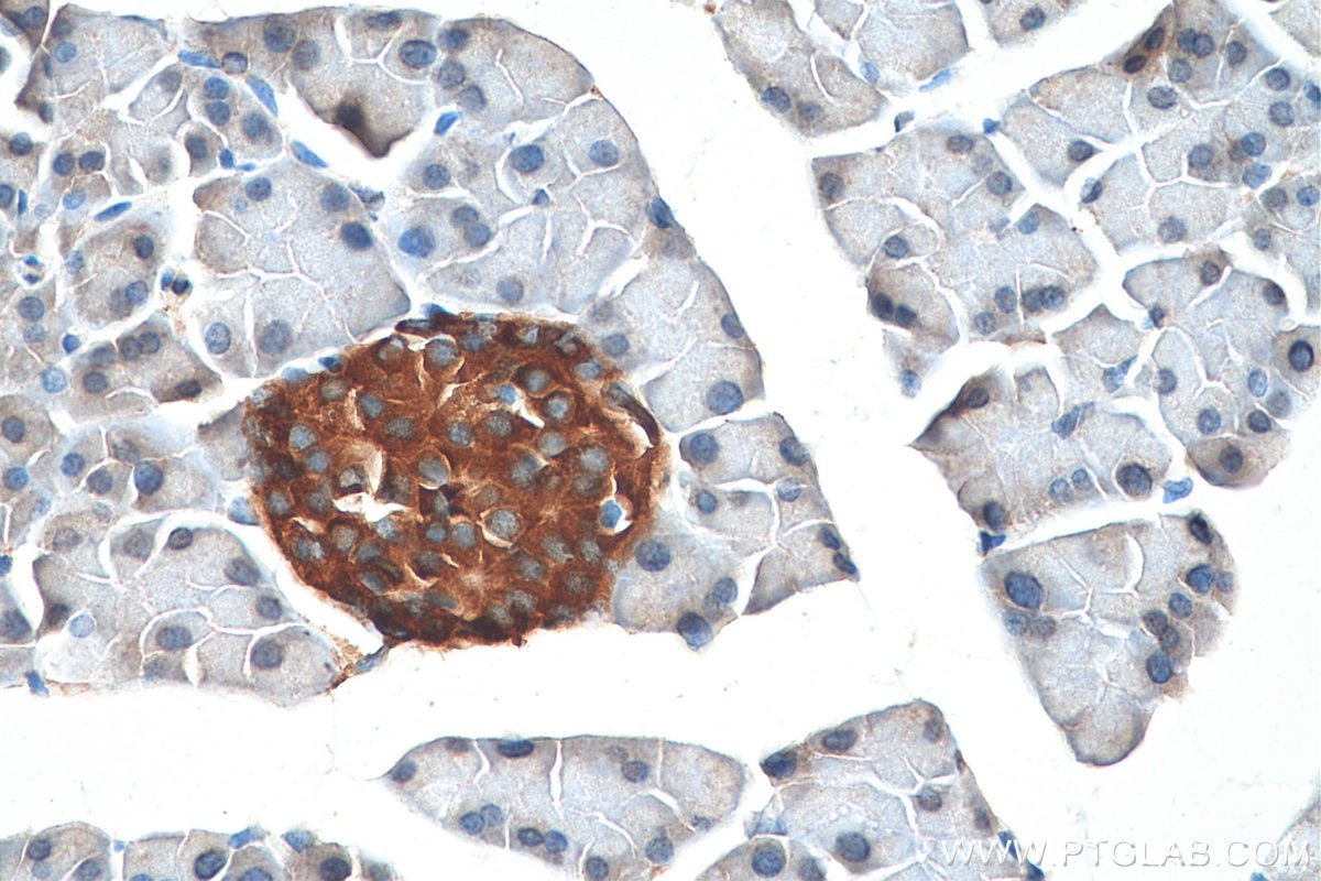 IHC staining of mouse pancreas using 10761-1-AP