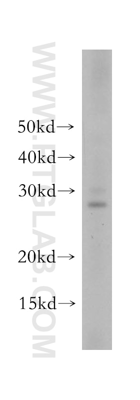 Western Blot (WB) analysis of mouse brain tissue using Secretogranin V Polyclonal antibody (10761-1-AP)