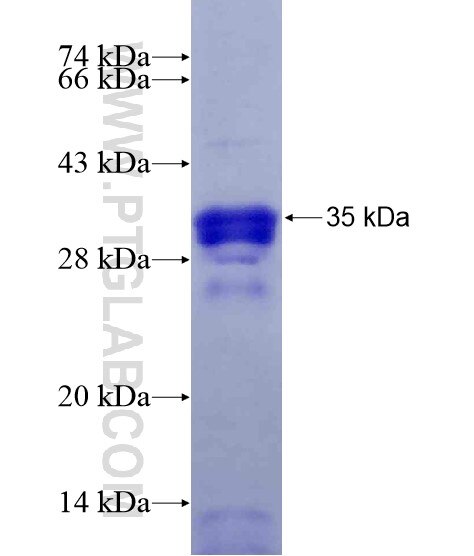 SCG5 fusion protein Ag28607 SDS-PAGE