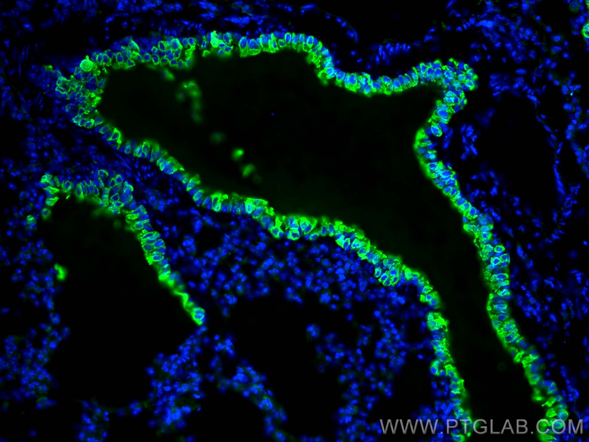Immunofluorescence (IF) / fluorescent staining of mouse lung tissue using Uteroglobin/CC10 Polyclonal antibody (10490-1-AP)
