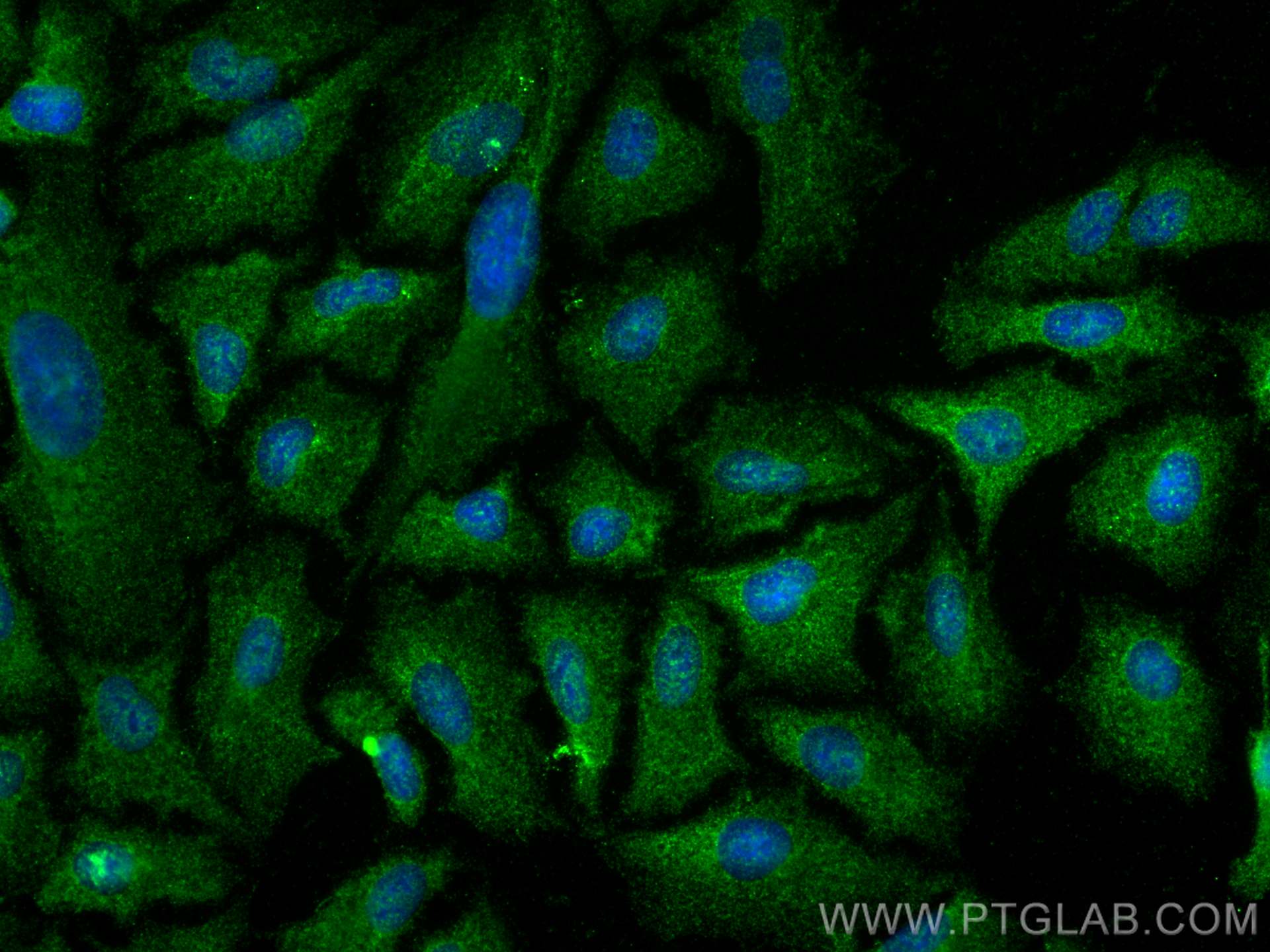 Immunofluorescence (IF) / fluorescent staining of A549 cells using Uteroglobin/CC10 Polyclonal antibody (10490-1-AP)