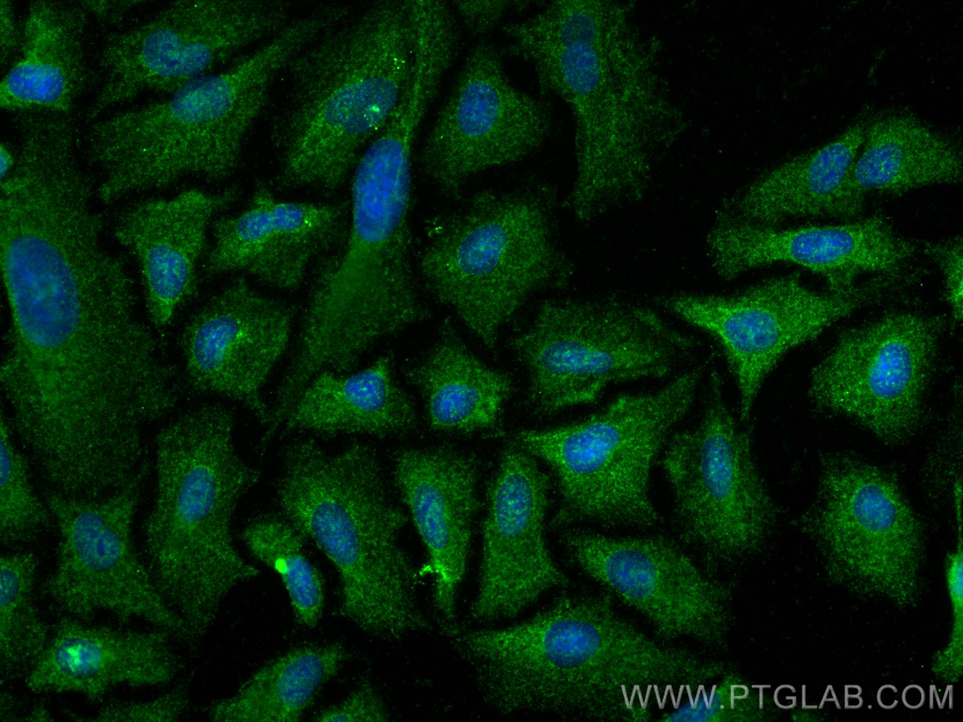 IF Staining of A549 using 10490-1-AP