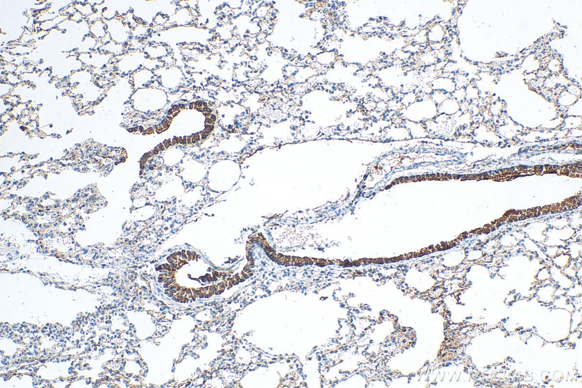 Immunohistochemistry (IHC) staining of mouse lung tissue using Uteroglobin/CC10 Polyclonal antibody (10490-1-AP)