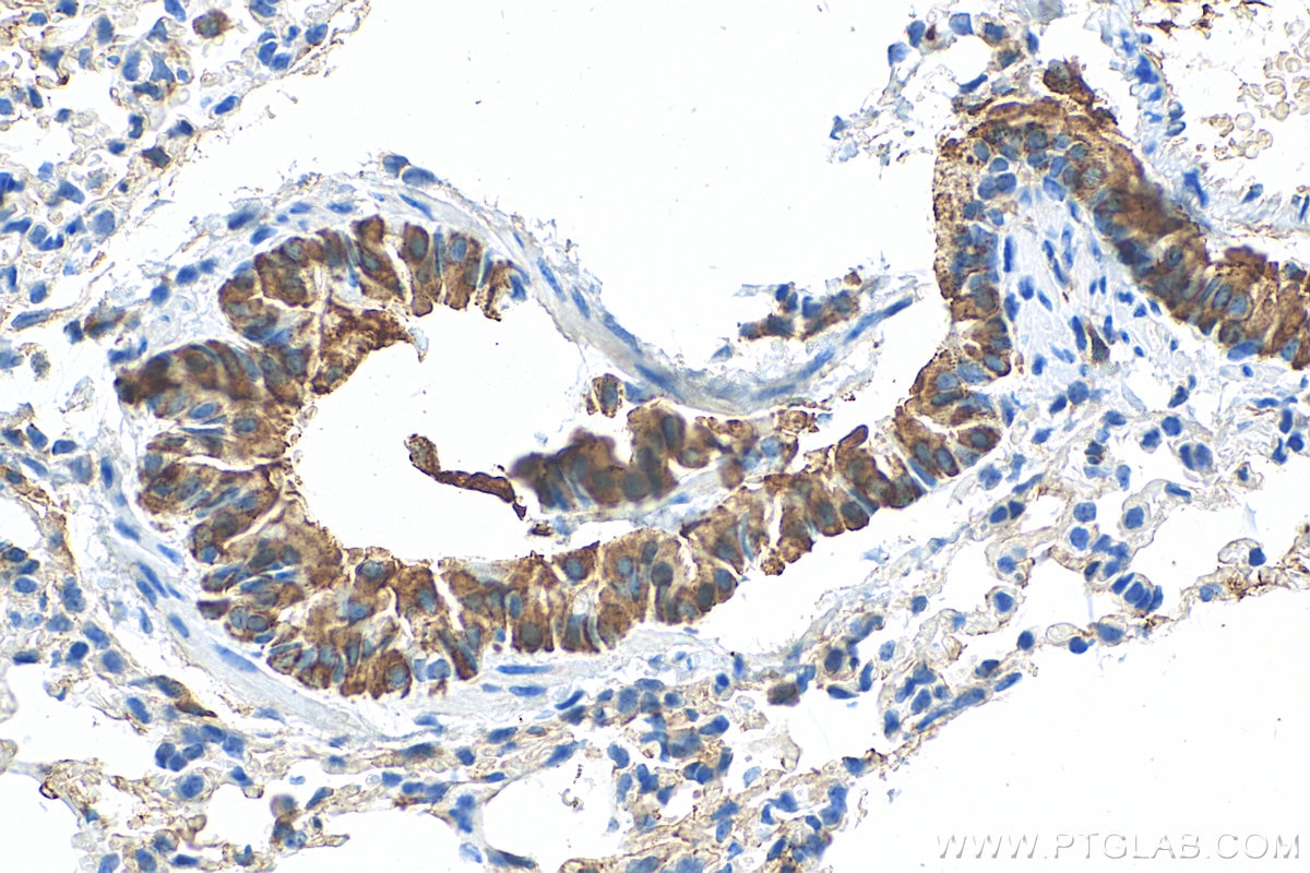 Immunohistochemistry (IHC) staining of mouse lung tissue using Uteroglobin/CC10 Polyclonal antibody (10490-1-AP)