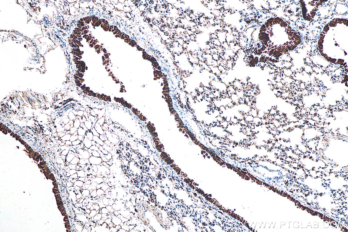 Immunohistochemistry (IHC) staining of mouse lung tissue using Uteroglobin/CC10 Polyclonal antibody (10490-1-AP)