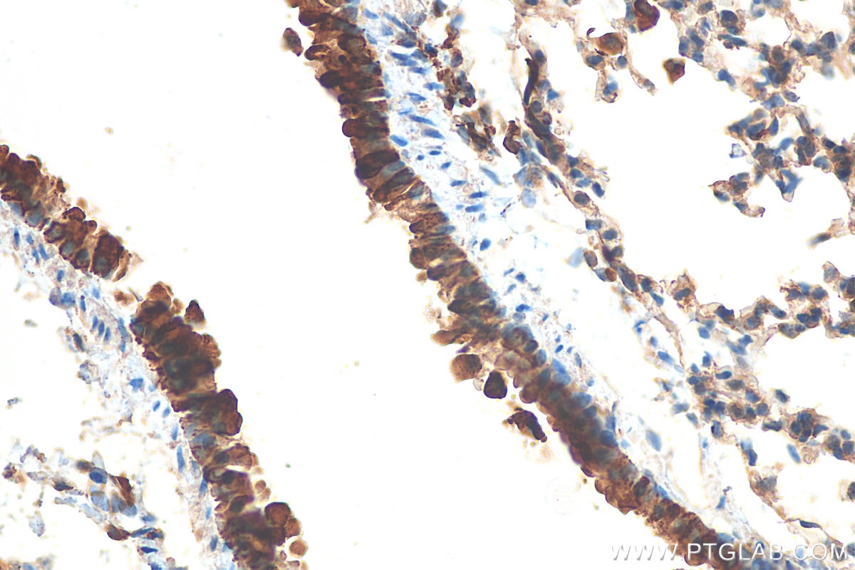 Immunohistochemistry (IHC) staining of mouse lung tissue using Uteroglobin/CC10 Polyclonal antibody (10490-1-AP)